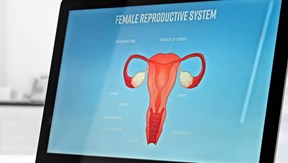 Endometriose und Fruchtbarkeit